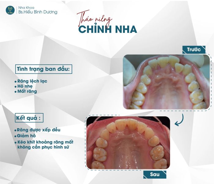 Hình ảnh đội ngũ bác sĩ chuyên nghiệp tại Nha Khoa BS.Hiếu