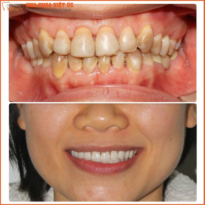 Hình ảnh phòng điều trị Nha khoa Việt Úc - Tiêu chuẩn quốc tế
