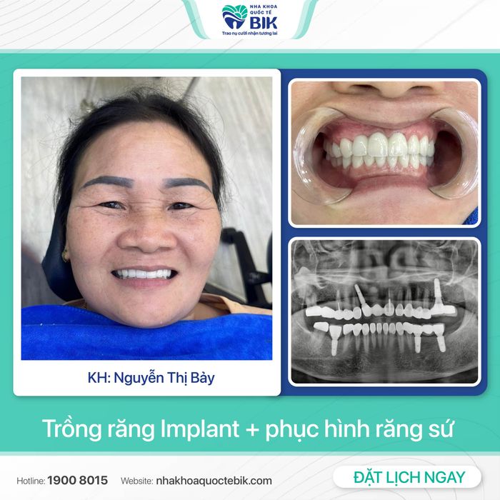Cơ sở vật chất hiện đại tại Nha Khoa Quốc Tế BIK