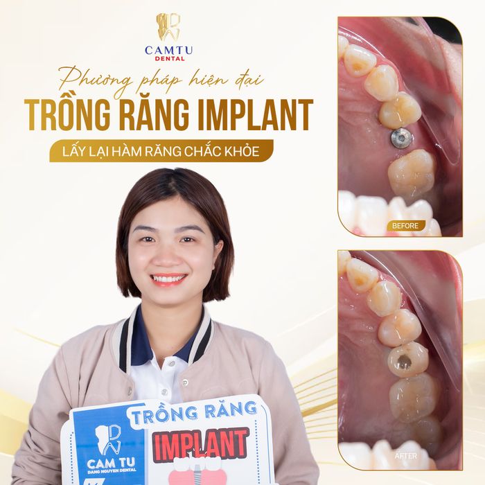 Hệ thống trang thiết bị hiện đại tại Nha Khoa Cẩm Tú
