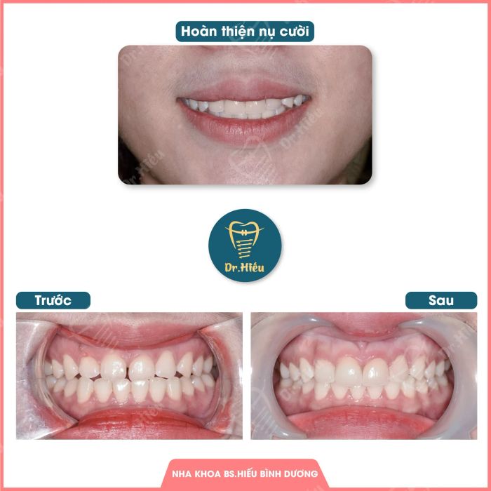 Hình ảnh thực tế Nha Khoa BS.Hiếu Bình Dương (ảnh 1)