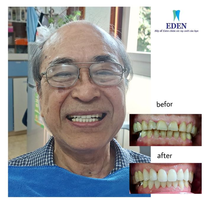 Hình ảnh không gian Nha khoa EDEN Dental Care - Đẳng cấp Châu Âu