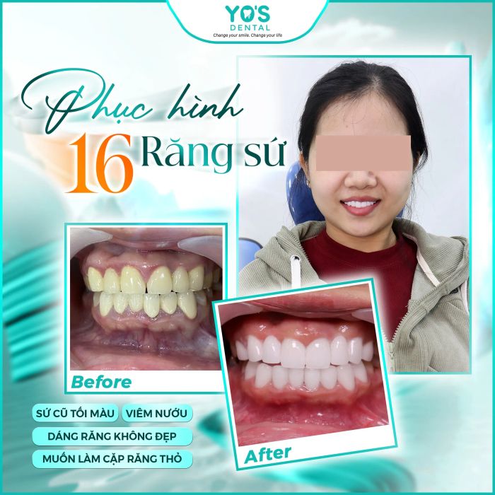 Hình ảnh thực tế Nha khoa Sài Gòn Bình Dương (ảnh 1)