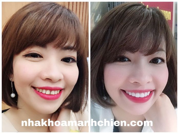 Hình ảnh đội ngũ bác sĩ Nha Khoa Mạnh Chiến - Chuyên môn cao, tận tâm