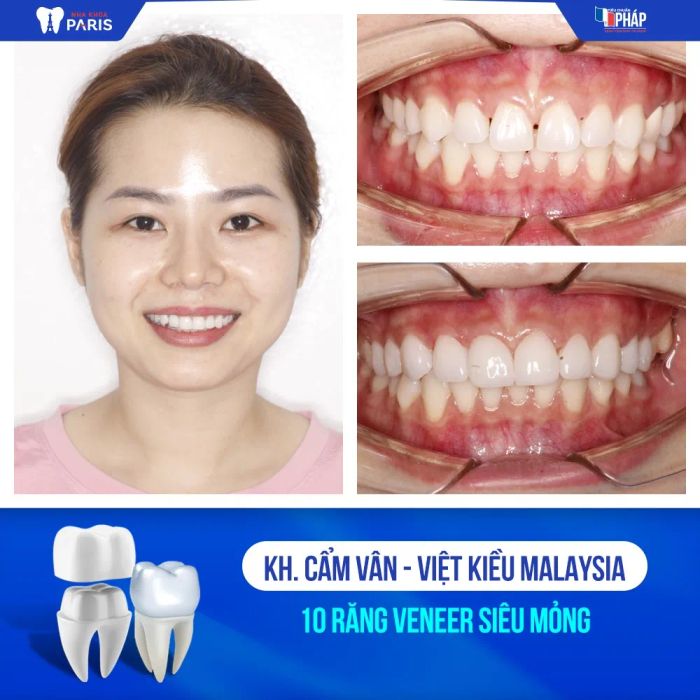 Hình ảnh thực tế Nha khoa Paris Bình Dương (ảnh 2)