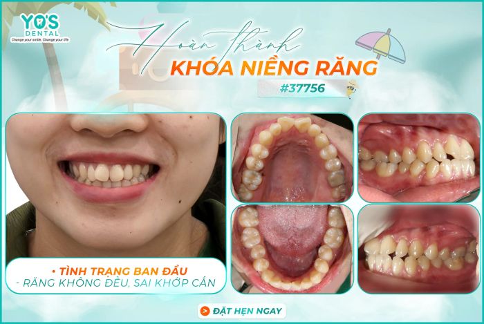 Hình ảnh phòng khám tiêu chuẩn tại Nha Khoa Sài Gòn