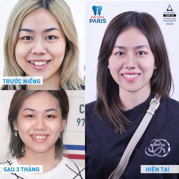 Hình ảnh Nha khoa Paris Bình Dương