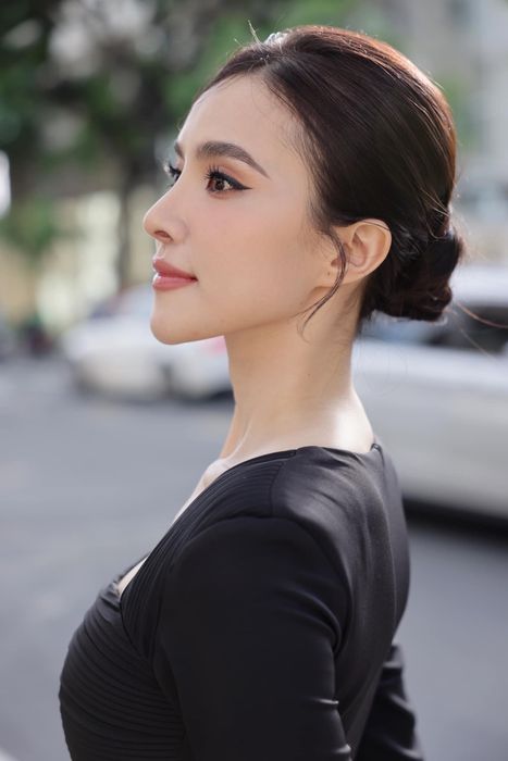 Hình ảnh thực tế Bệnh viện Thẩm Mỹ Việt Mỹ