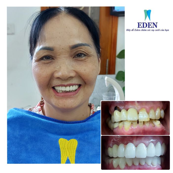 Hình ảnh Nha khoa EDEN Dental Care - Không gian sang trọng, đẳng cấp