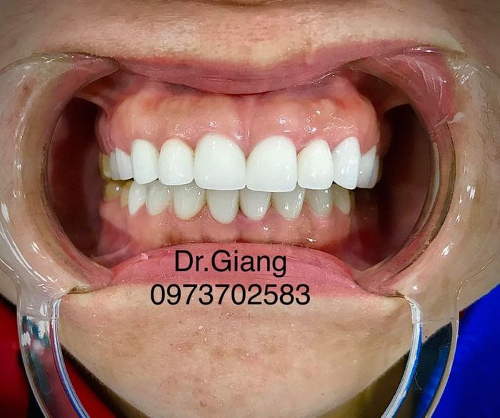 Hình ảnh Nha Khoa Garden Smile