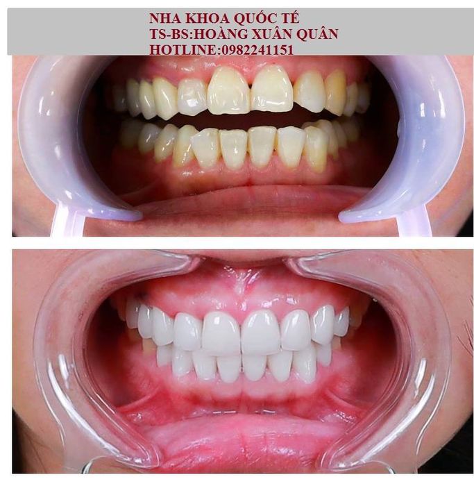 Không gian hiện đại tại Nha Khoa Quốc Tế Vinh