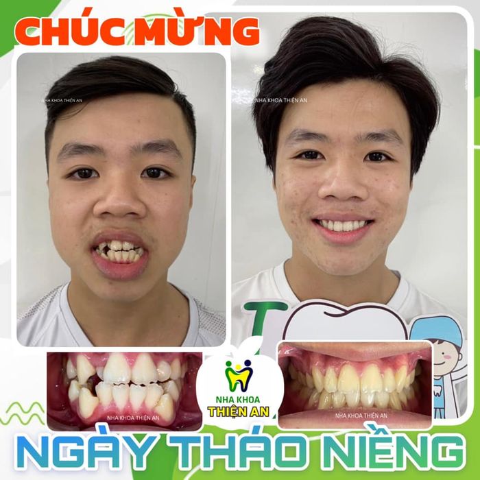 Không gian hiện đại và tiện nghi tại Nha Khoa Thiện An