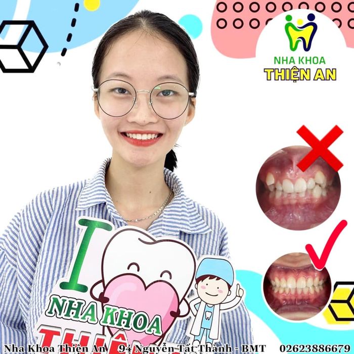 Hệ thống máy móc tiên tiến tại Nha Khoa Thiện An