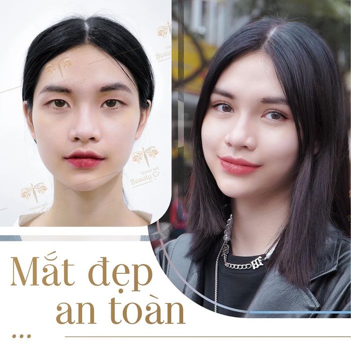 Hình ảnh thực tế về không gian sang trọng tại Thẩm Mỹ Beauty Center By Tấm