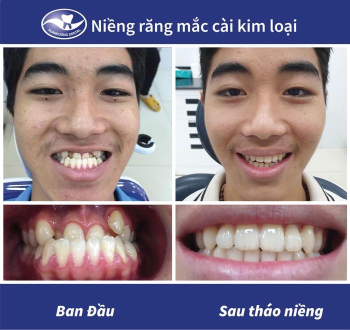 Hình ảnh ấn tượng về cơ sở vật chất tại Nha Khoa Xuân Hương