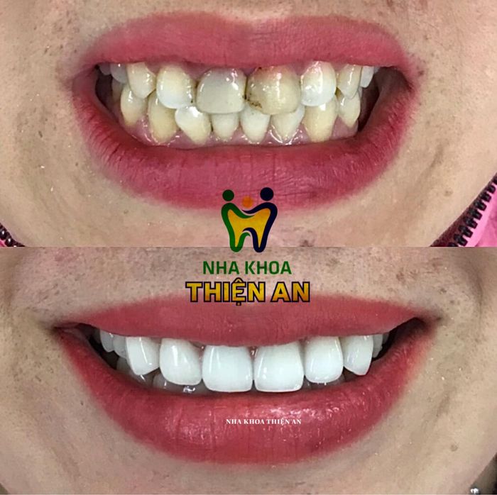 Hình ảnh Nha Khoa Thiện An Đăklăk 1 - Không gian hiện đại với trang thiết bị tiên tiến, nơi mỗi nụ cười được chăm sóc tỉ mỉ theo tiêu chuẩn quốc tế.