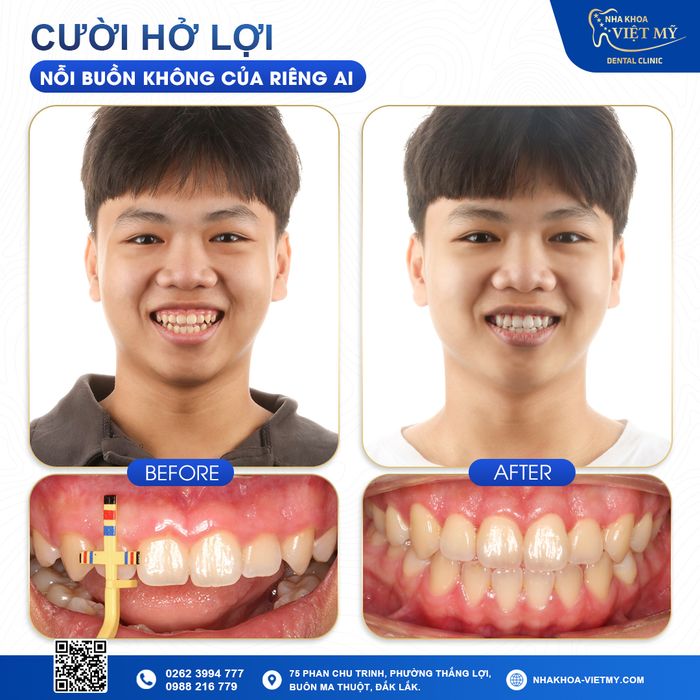 Hình ảnh thực tế về cơ sở vật chất hiện đại tại Nha Khoa Việt Mỹ