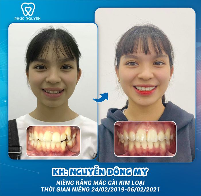 Hình ảnh Nha khoa Phúc Nguyên 2 - Hệ thống máy móc nhập khẩu hiện đại, phòng tiệt trùng đạt chuẩn, đảm bảo an toàn tuyệt đối cho mọi quy trình điều trị.