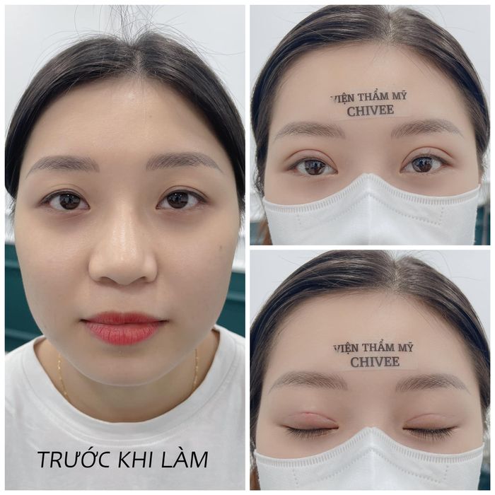 Không gian sang trọng và hiện đại tại Viện Thẩm Mỹ ChiVee