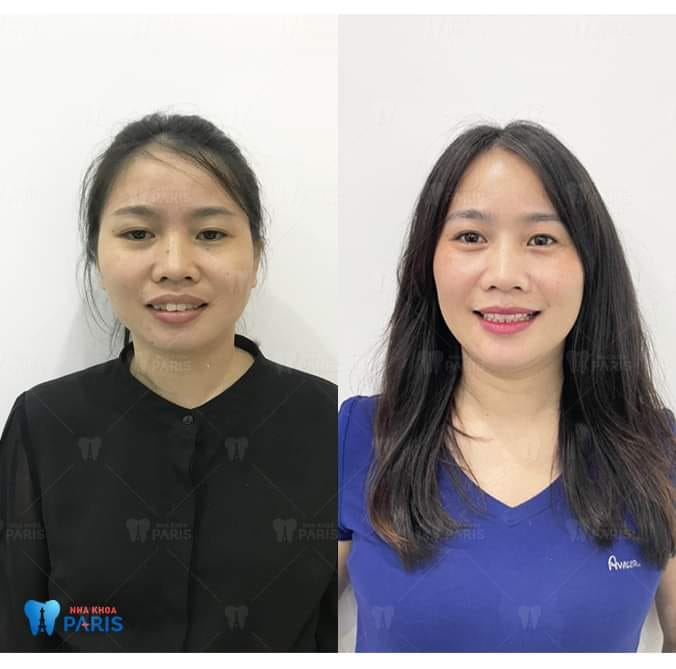 Hình ảnh cơ sở vật chất hiện đại tại Nha khoa Paris