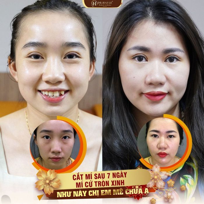 Hình ảnh Viện Thẩm Mỹ Y Khoa Dr.Hải Lê