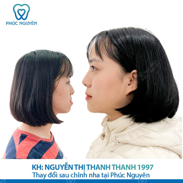 Hệ thống trang thiết bị tiên tiến tại Nha khoa Phúc Nguyên