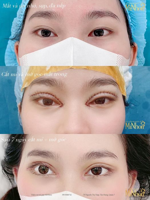 Không gian sang trọng và hiện đại tại Viện Thẩm Mỹ MiNhon
