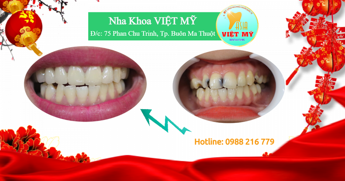 Hệ thống trang thiết bị tiên tiến của Nha khoa Việt Mỹ