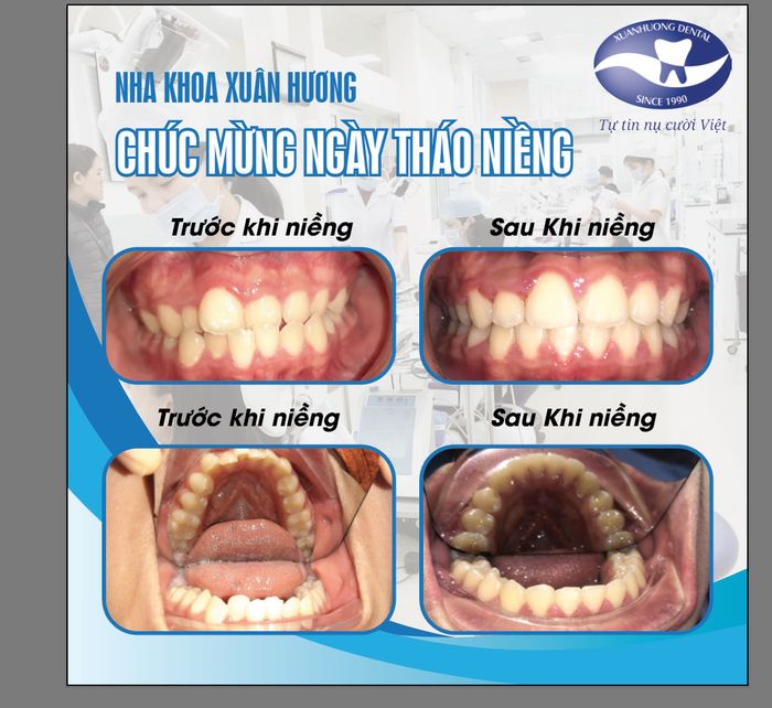 Hình ảnh thực tế về không gian Nha Khoa Xuân Hương