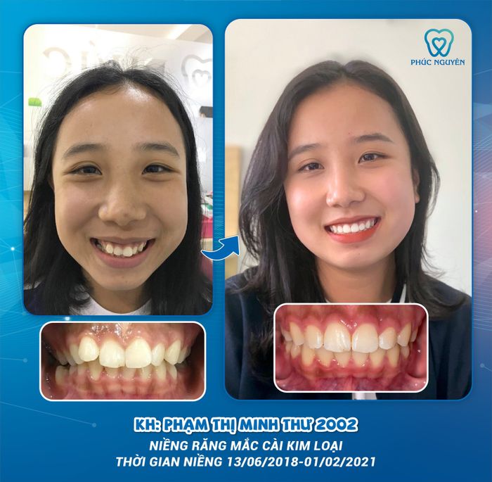 Hình ảnh Nha khoa Phúc Nguyên 1 - Không gian hiện đại, tiện nghi với phòng khám tiêu chuẩn quốc tế, nơi mỗi chi tiết đều được đầu tư kỹ lưỡng vì sự thoải mái của khách hàng.