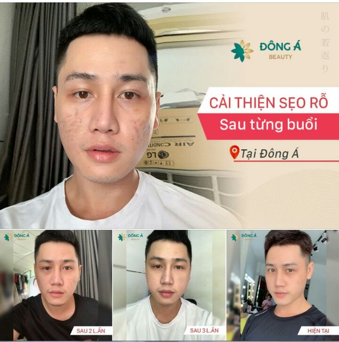 Hệ thống phòng điều trị hiện đại tại Thẩm Mỹ Viện Đông Á