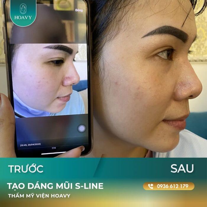 Khoảnh khắc ấn tượng tại Thẩm Mỹ Viện HoaVy 2