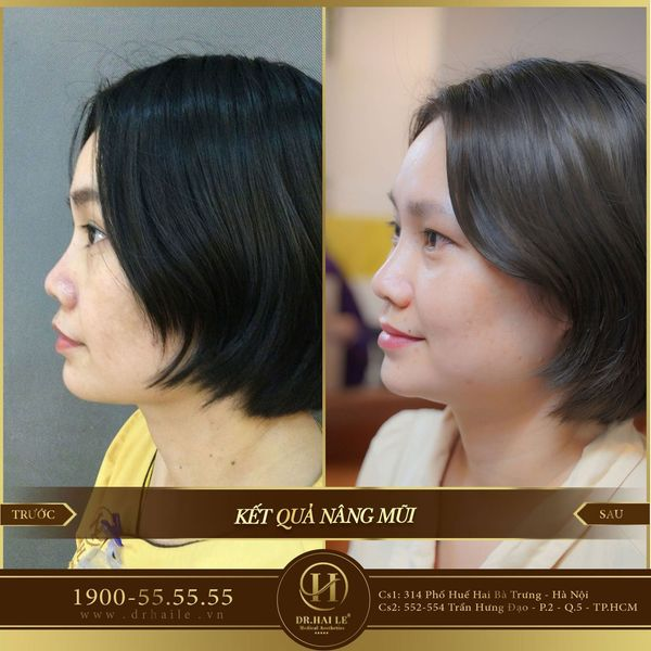 Hệ thống phòng phẫu thuật hiện đại tại Viện Thẩm mỹ Dr. Hải Lê