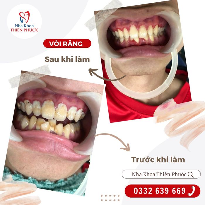 Hình ảnh Nha Khoa Thiên Phước