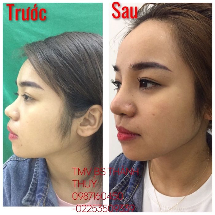 Hình ảnh Thẩm mỹ viện bác sĩ Thành Thủy 2