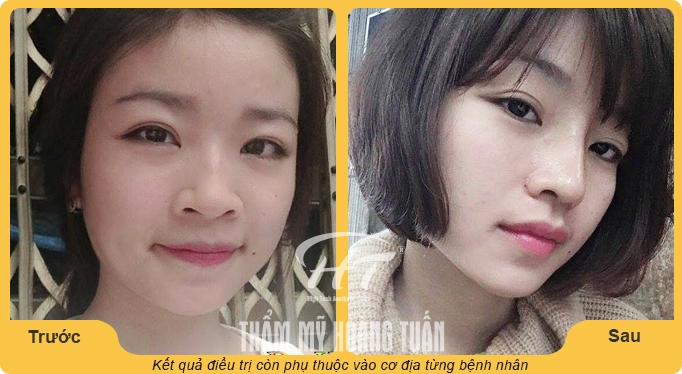 Hình ảnh thực tế Dr Hoàng Tuấn