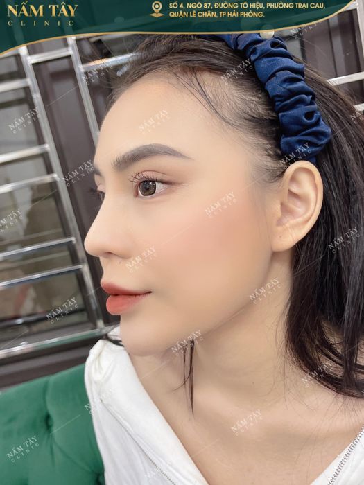 Hình ảnh Nấm Tây Clinic 2