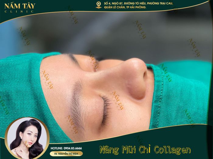 Hình ảnh Nấm Tây Clinic 1