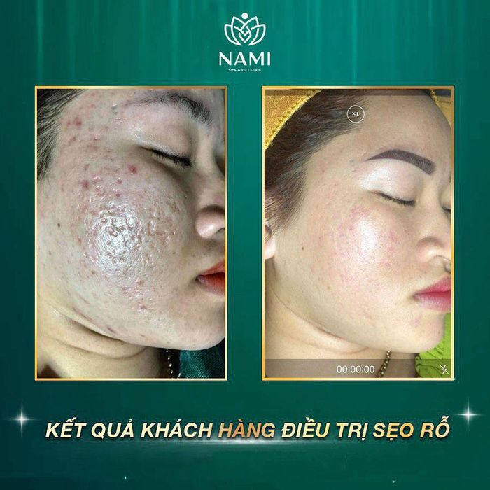 Không gian trị liệu cao cấp tại Nami Spa Beauty & Clinic