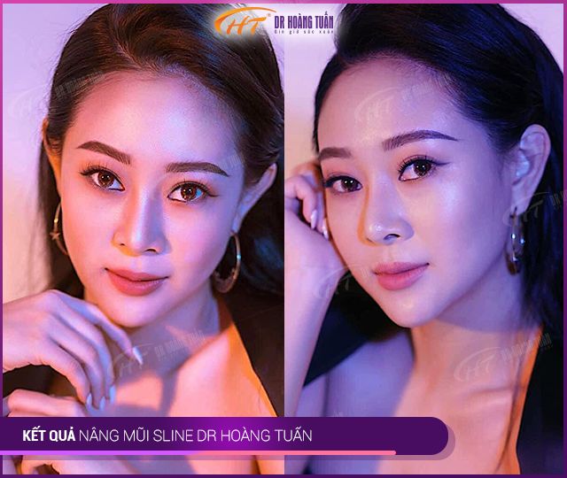 Hình ảnh Thẩm Mỹ Hoàng Tuấn Hải Phòng 1