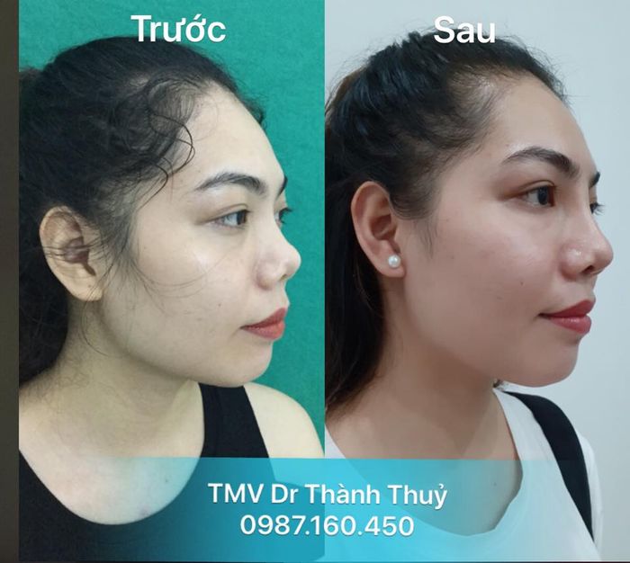 Hình ảnh Thẩm mỹ viện bác sĩ Thành Thủy 1