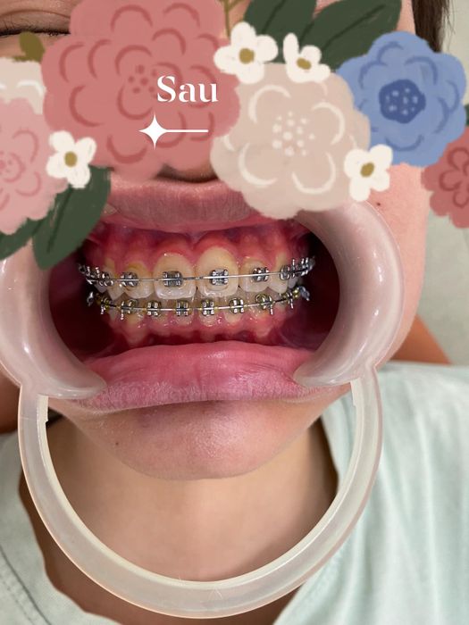 Hình ảnh phòng khám hiện đại và đội ngũ bác sĩ chuyên nghiệp tại Nha Khoa Quốc Tế Nhà Bàng