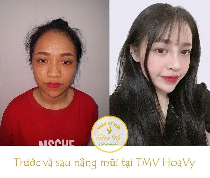 Hình ảnh nổi bật tại Thẩm Mỹ Viện HoaVy 1