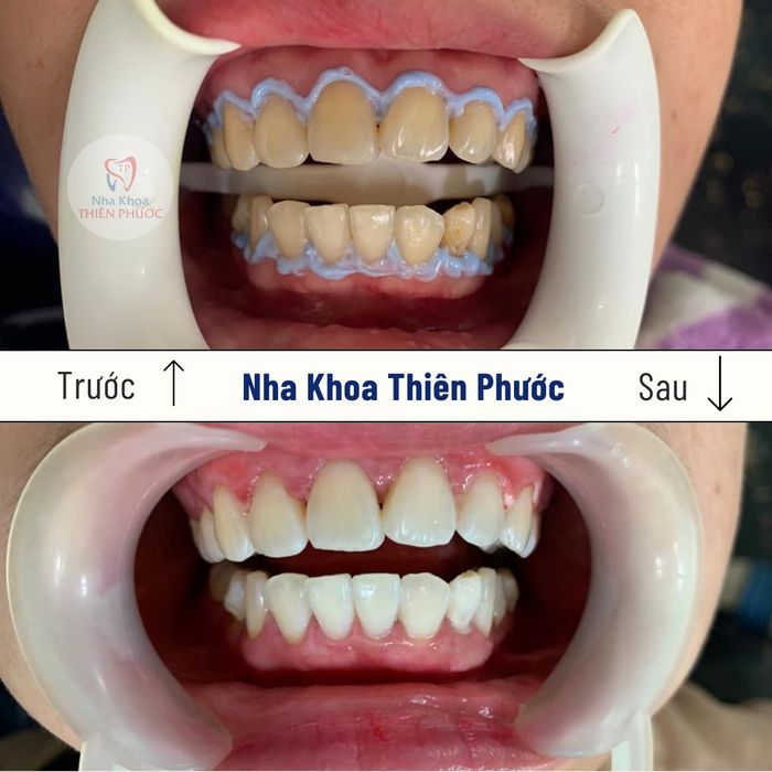 Hình ảnh thực tế về cơ sở vật chất hiện đại tại Nha Khoa Thiên Phước