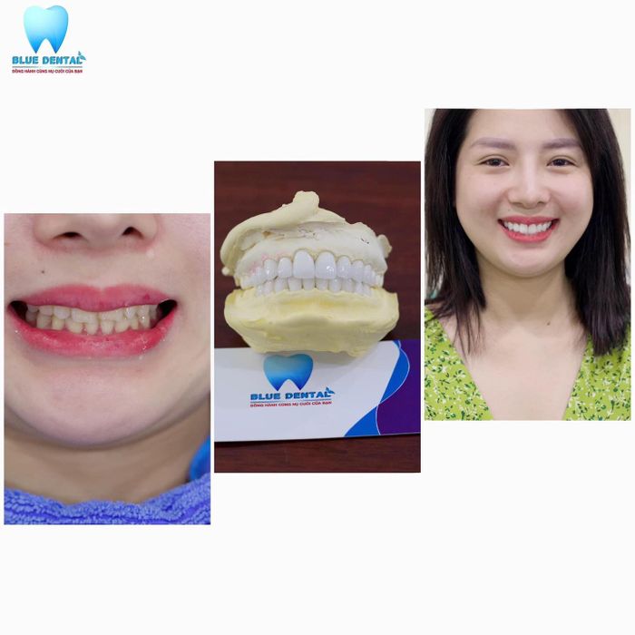 Không gian hiện đại và tiện nghi tại Nha Khoa Blue Dental