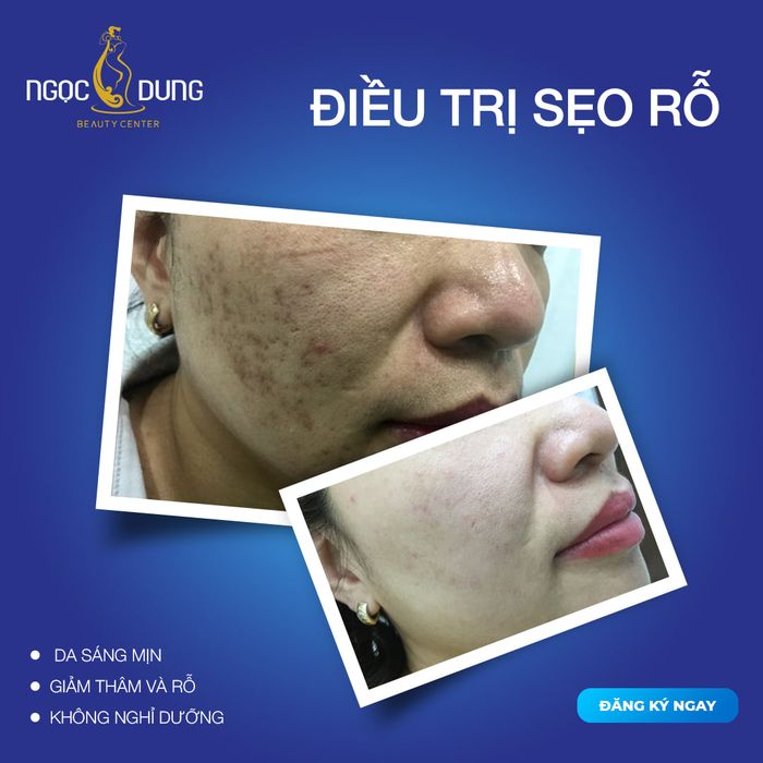 Hệ thống máy móc công nghệ cao tại Thẩm Mỹ Viện Ngọc Dung