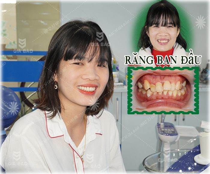 Hình ảnh đội ngũ bác sĩ chuyên nghiệp tại Nha Khoa Gia Bảo