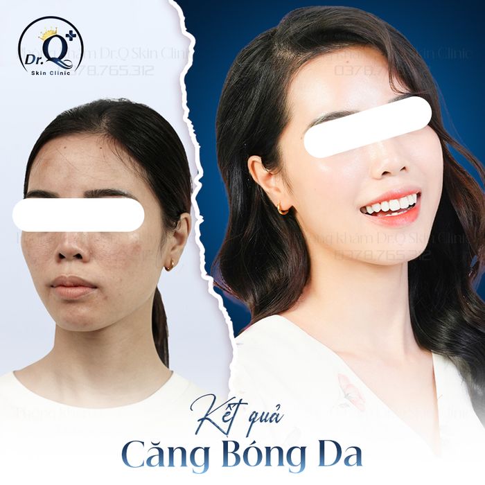 Hệ thống máy móc hiện đại tại Dr.Q Skin Clinic