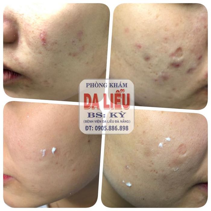 Hệ thống máy móc điều trị da tại Phòng Khám BS Tôn Thất Minh Kỳ