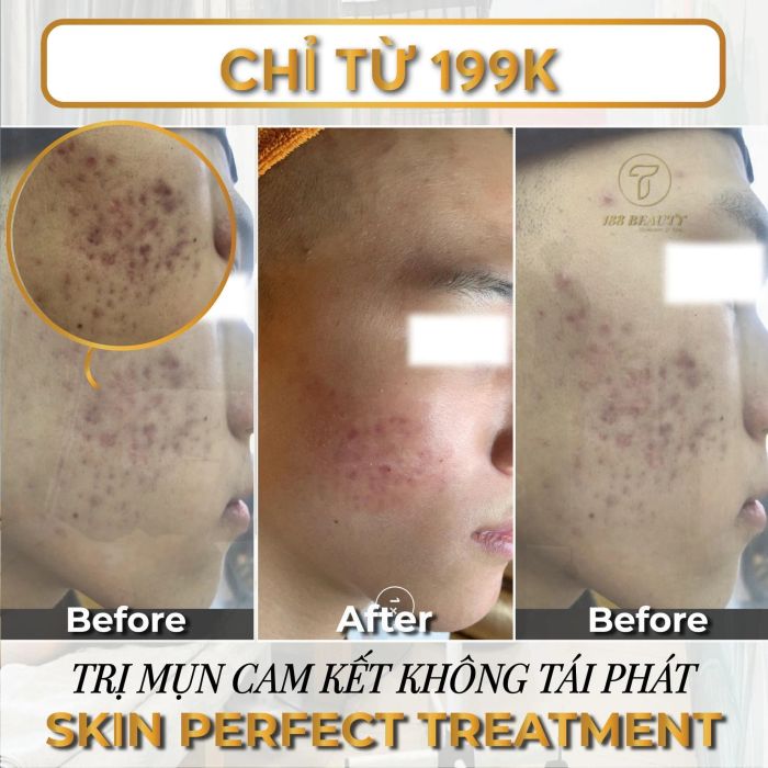 Không gian sang trọng và hiện đại tại Spa Shynh Beauty